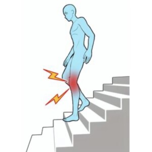 膝は痛くないのに「カクッ？」不安定さの正体